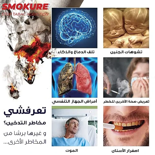 سموكور 4